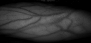 The Vein-Eye Carry or Vein Locating System - Image 5